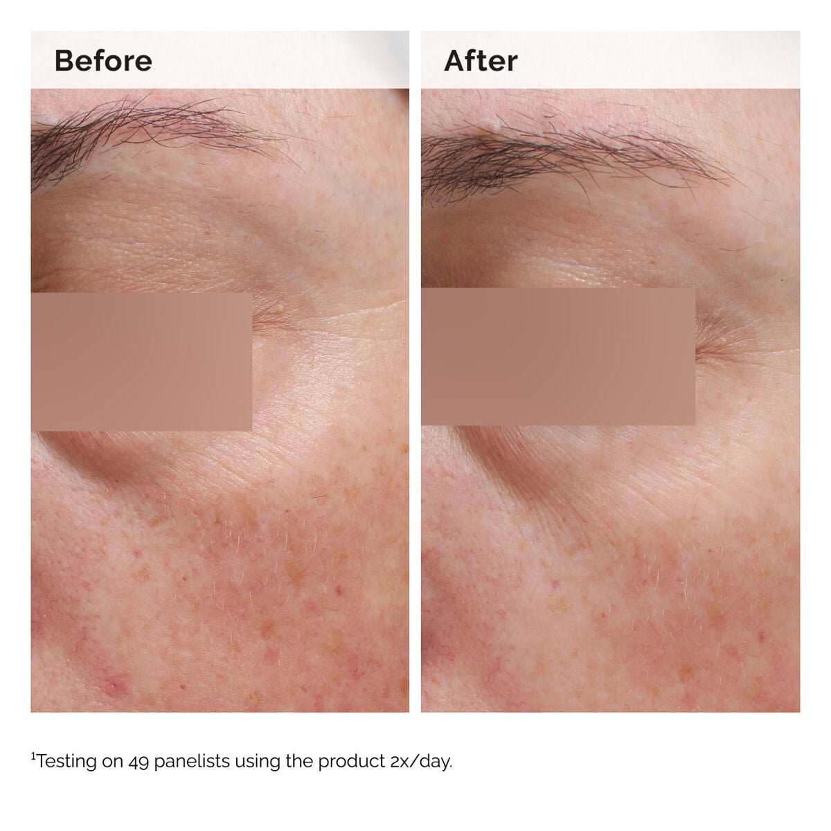 niacinamide-5-face-and-body-emulsion-k2 2024-08-23-ORD-Nia-5pct-Face-Body-B-A-Elasticity-Global-02-1x1.jpg