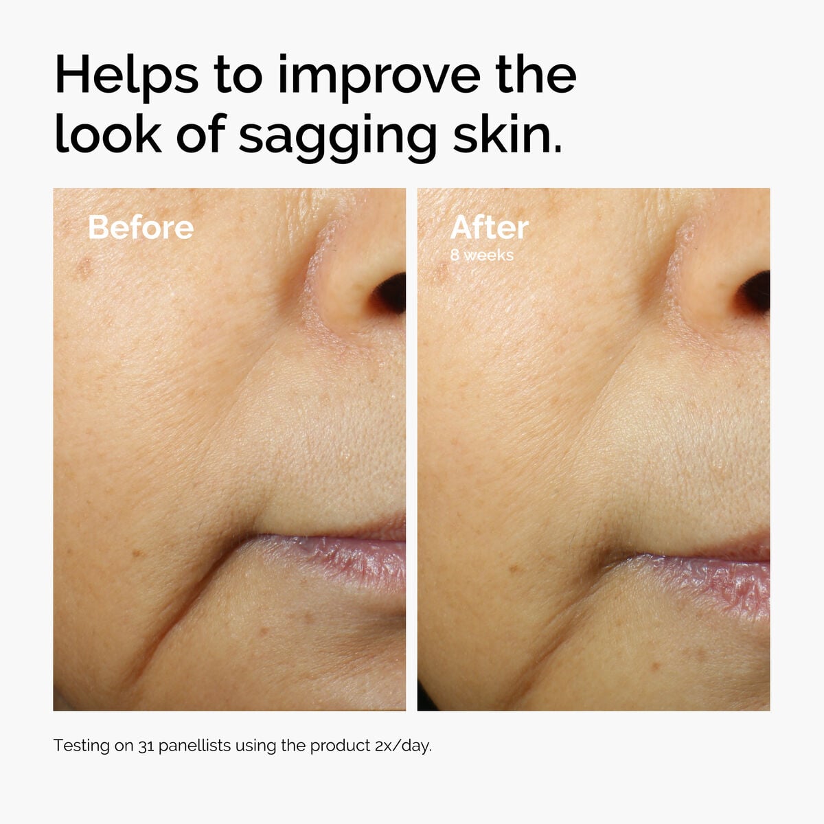 caffeine-3-escin-1-face-serum-g0 ord-caffeine-3pct-escin-1pct-face-serum-before-after-sagging.jpg