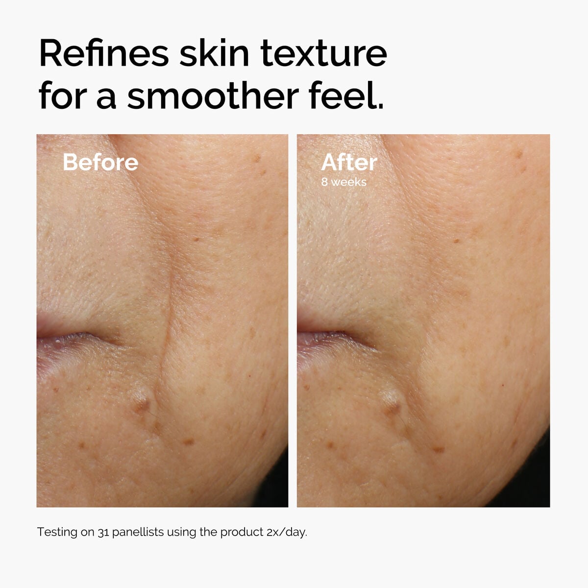 caffeine-3-escin-1-face-serum-g0 ord-caffeine-3pct-escin-1pct-face-serum-before-after-texture.jpg