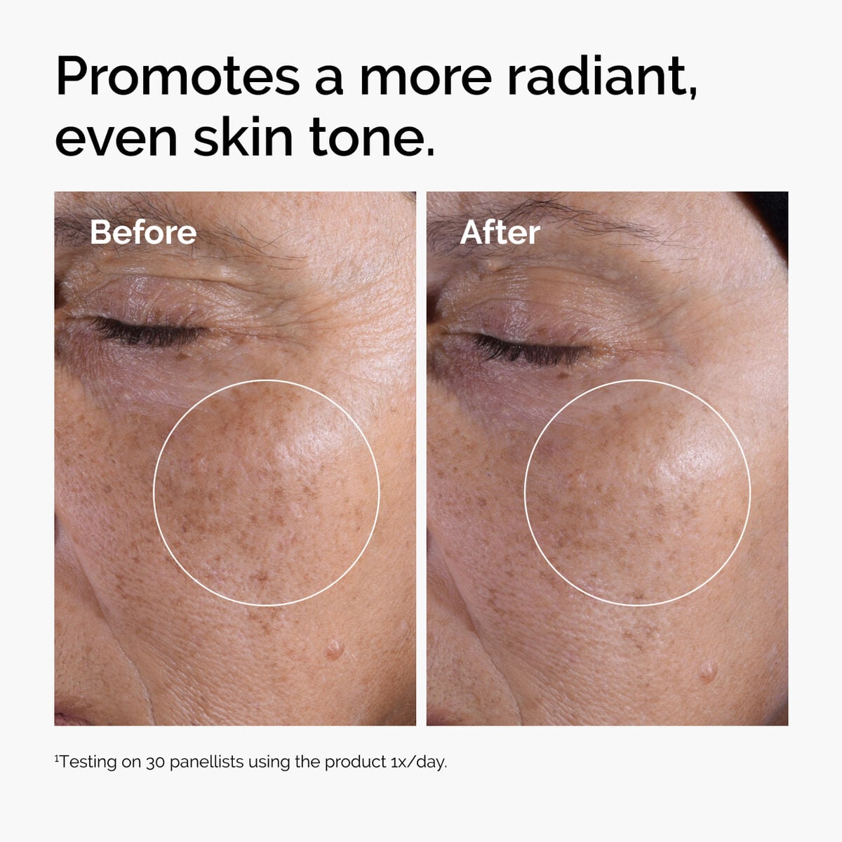 glycolic-acid-7-exfoliating-toner-p9 ord-glycolic-before-after-radiance.jpg