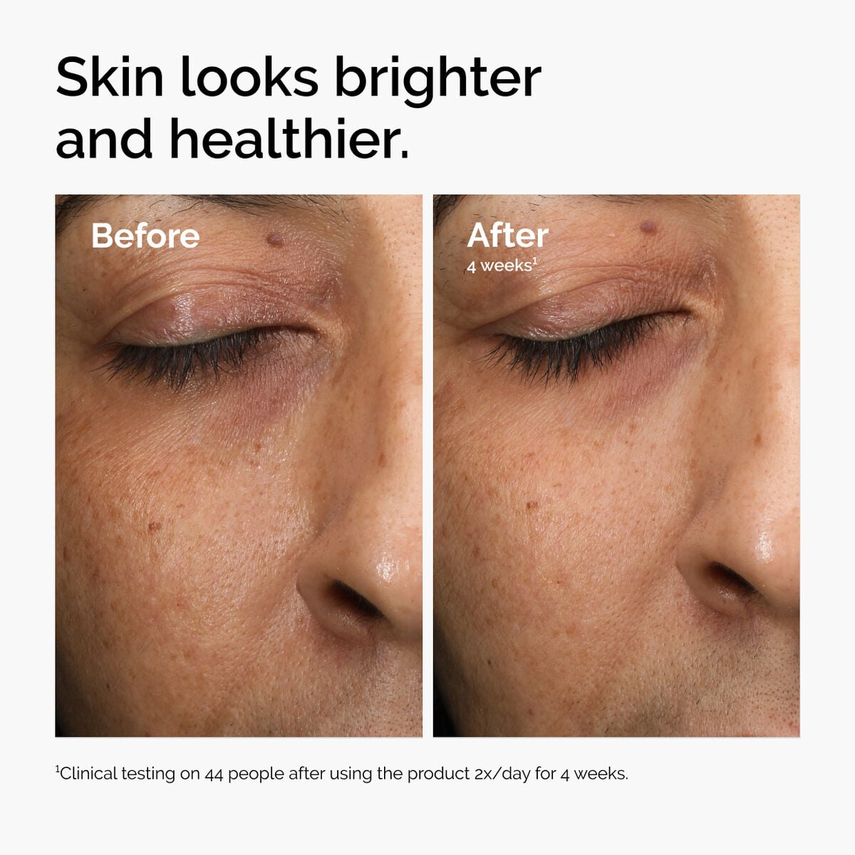 multi-antioxidant-radiance-serum-q9 ord-mars-before-after-healthy.jpg