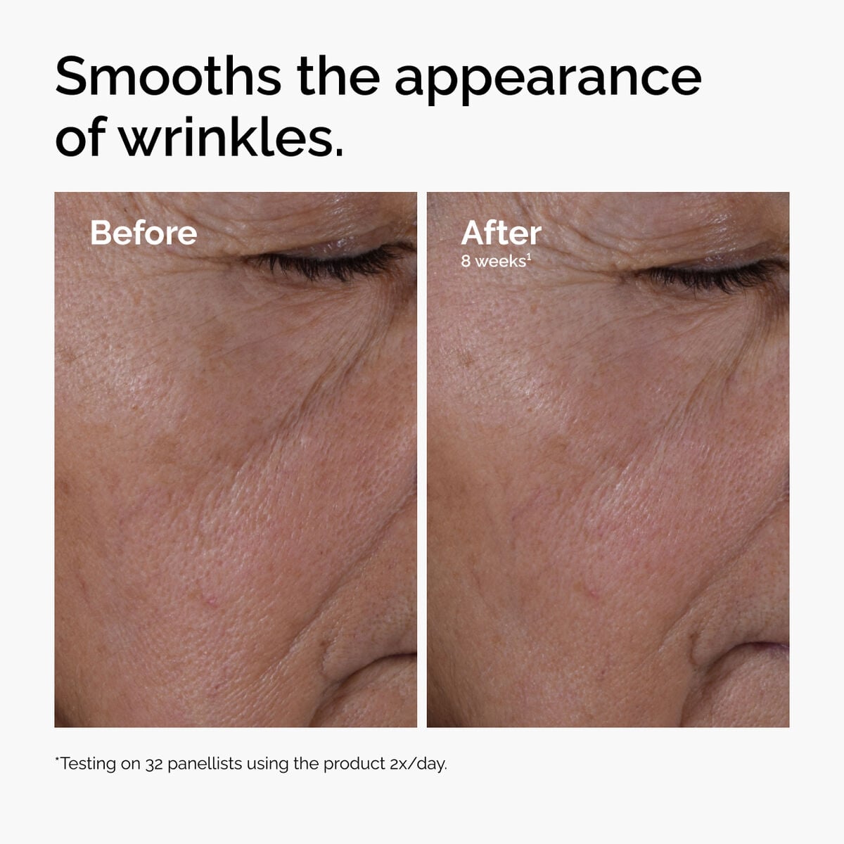 multi-peptide-ha-serum-g9 ord-multi-peptide-ha-serum-wrinkles-before-after.jpg