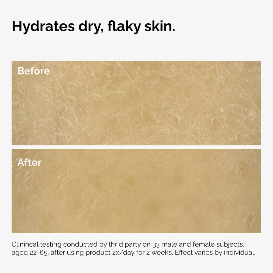 the-body-care-collection-a7 ord-natural-moisturizing-factors-inulin-body-before-after-graphic-02.jpg