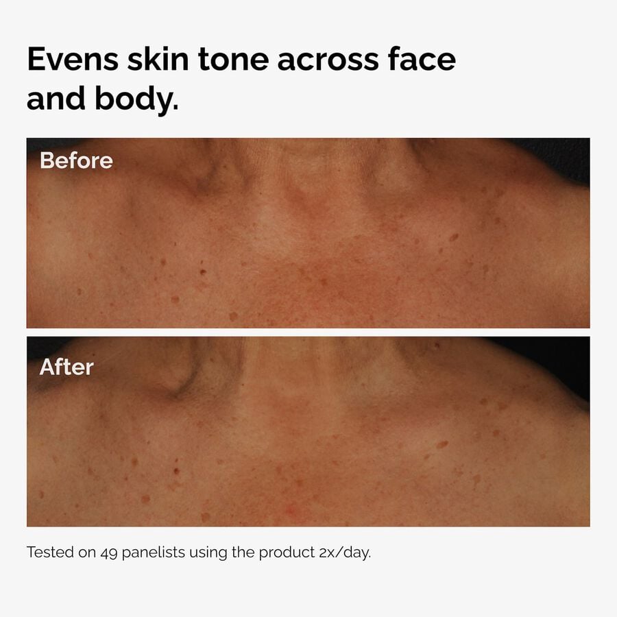 the-body-care-collection-a7 ord-niacinamide-face-body-serum-before-after-even-tone-graphic.jpg