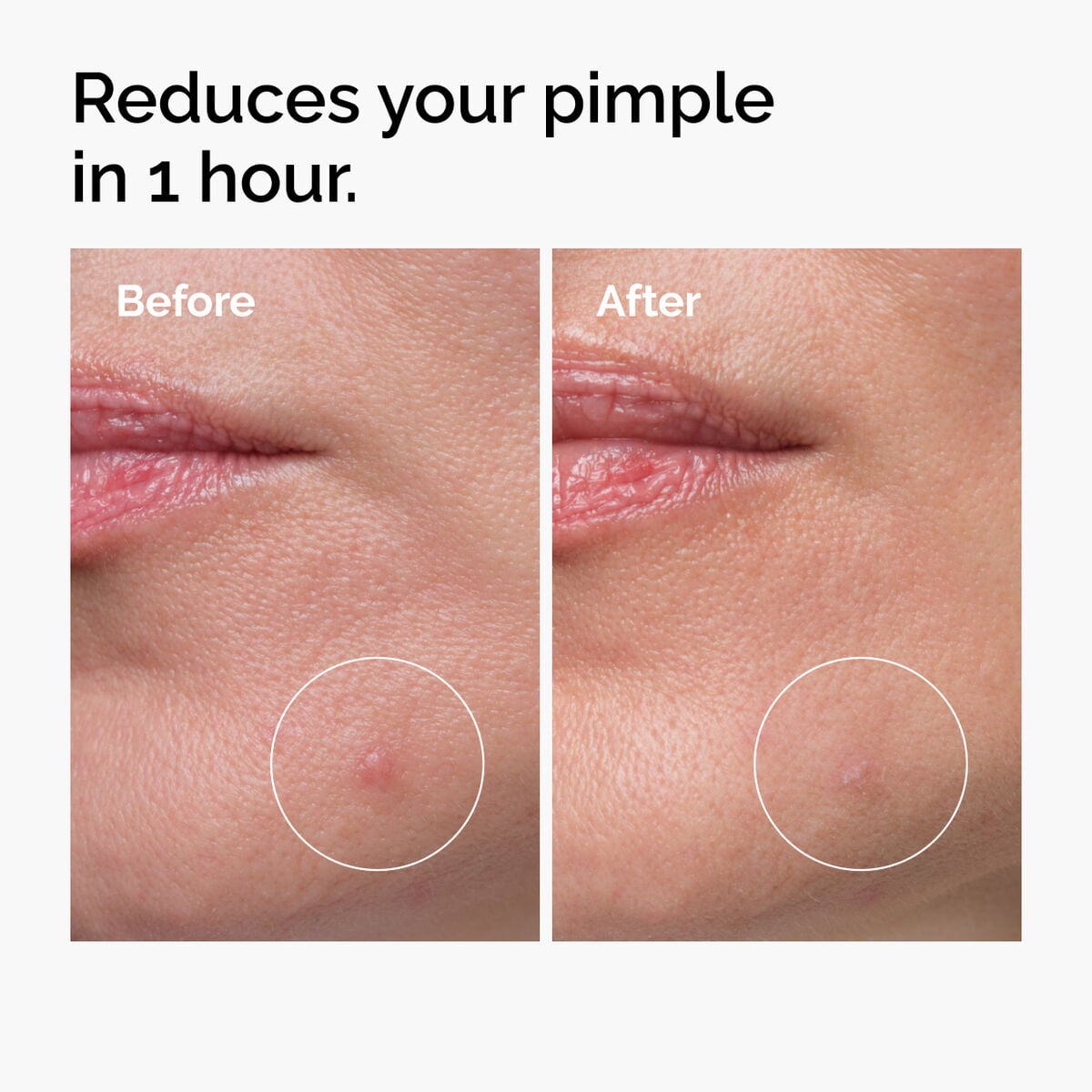 sulfur-10-powder-to-cream-concentrate-j8 ord-sulfur-10pct-powder-to-cream-concentrate-before-after-NA.jpg